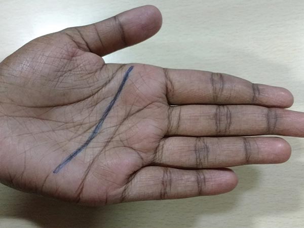 મસ્તિષ્ક રેખા