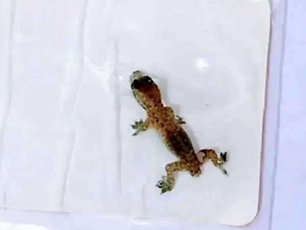 જ્યારે ડૉક્ટરે ગરોળી બહાર કાઢી, તો સૌ ચોંકી ઉ